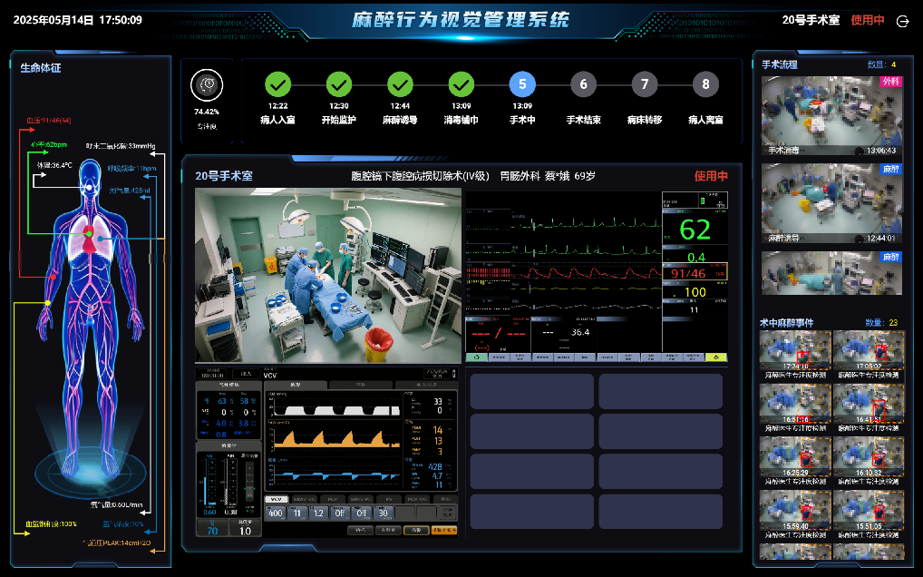 手术流程节点自动识别